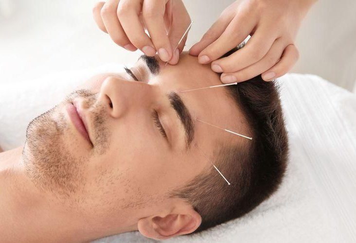 بهترین دکتر طب سوزنی اصفهان