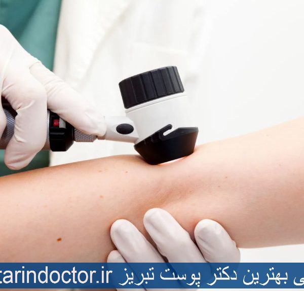 معرفی بهترین دکتر پوست تبریز