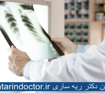 بهترین دکتر ریه ساری
