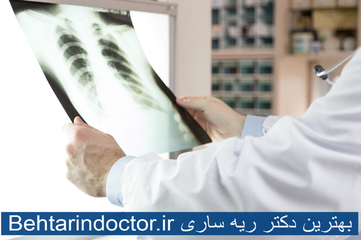 بهترین دکتر ریه ساری