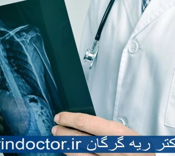 بهترین دکتر ریه گرگان