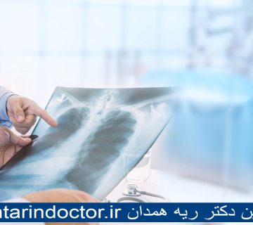 بهترین دکتر ریه همدان