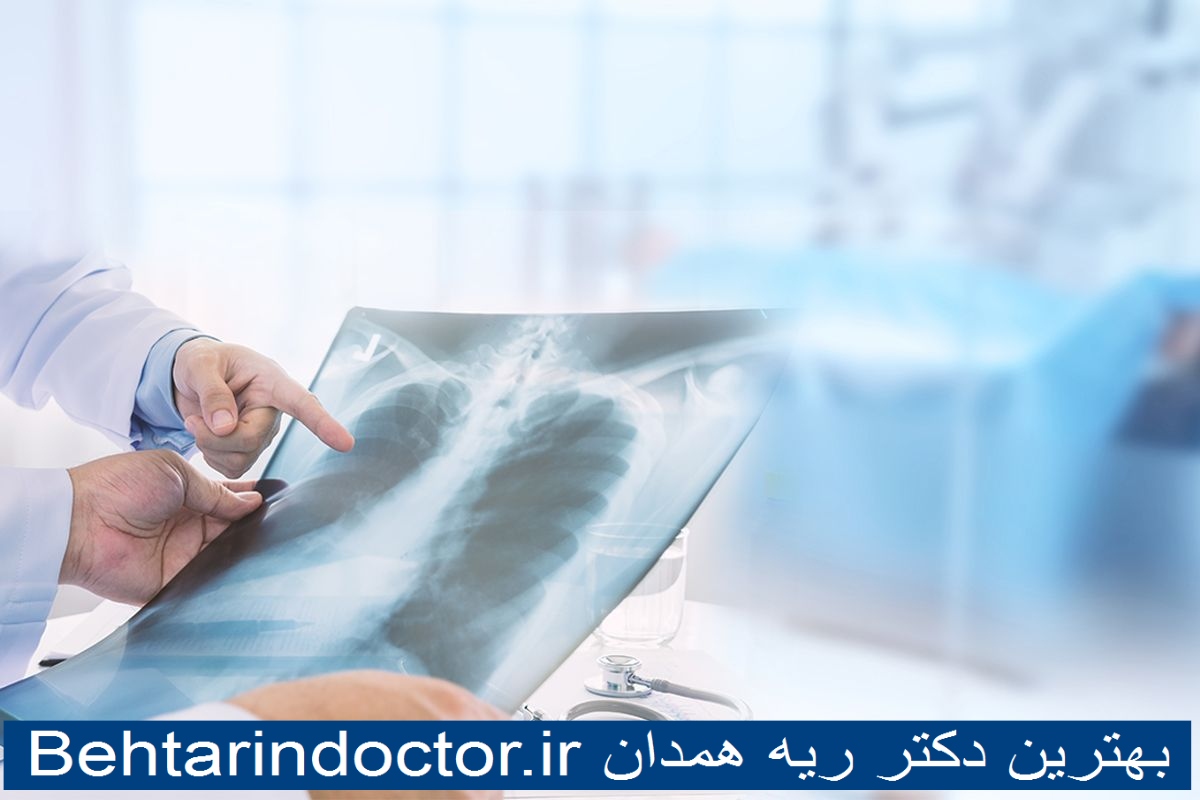 بهترین دکتر ریه همدان