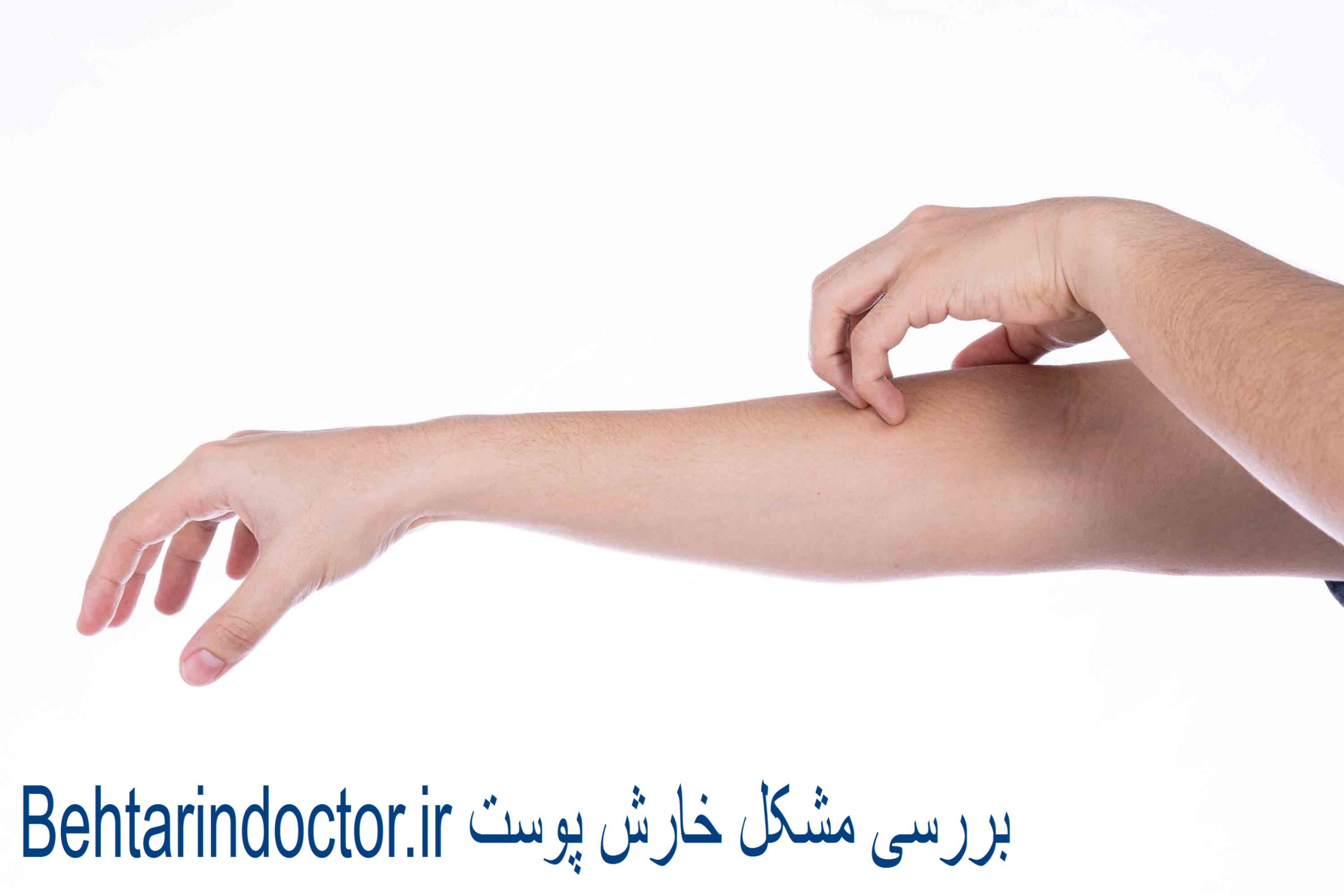 خارش پوست ، علل ، درمان ، عوارض و پیشگیری