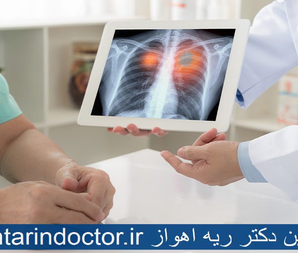 بهترین دکتر ریه اهواز