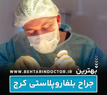 بهترین دکتر جراح بلفاروپلاستی کرج