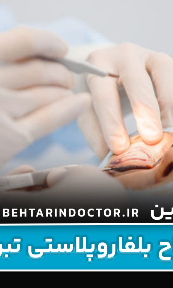 بهترین جراح بلفاروپلاستی تبریز