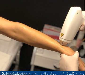 لیزر موهای زائد بدن - بهترین کلینیک زیبایی در مشهد