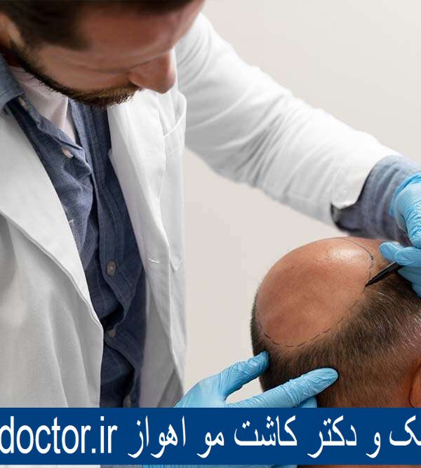 بهترین کلینیک و دکتر کاشت مو اهواز