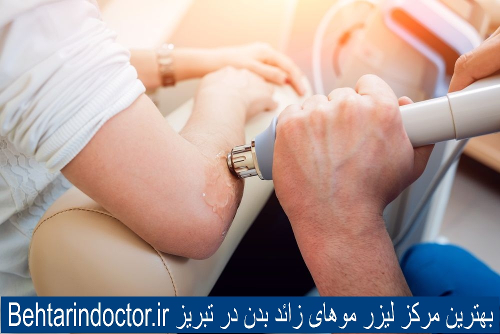 لیزر موهای زائد بدن - بهترین کلینیک زیبایی در تبریز