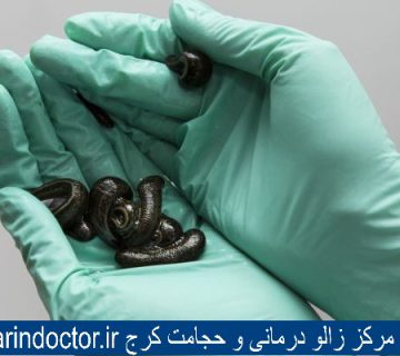 بهترین مرکز زالو درمانی و حجامت کرج