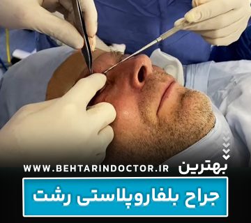 بهترین دکتر جراح بلفاروپلاستی رشت