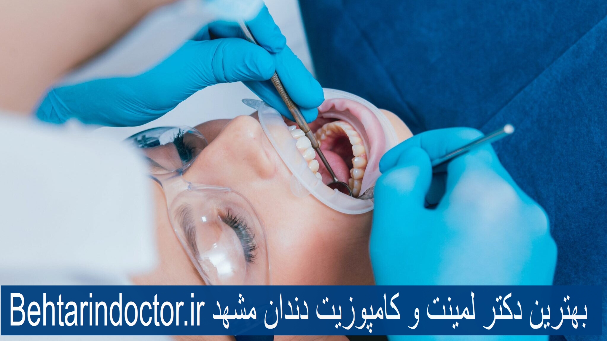 بهترین دکتر لمینت و کامپوزیت دندان مشهد
