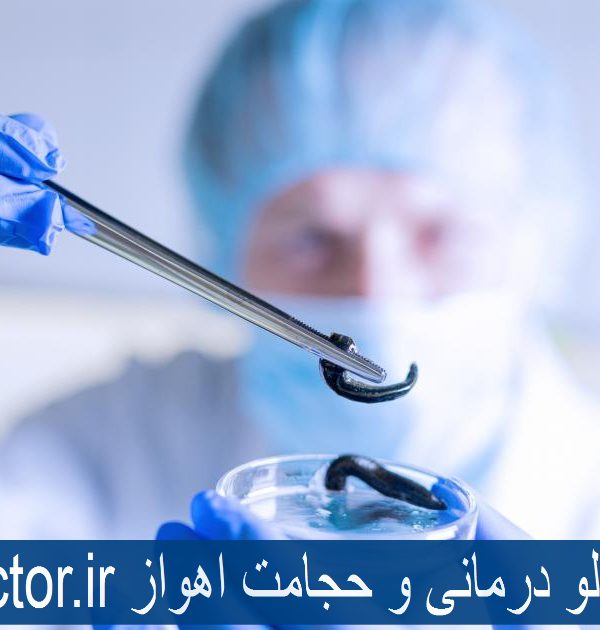 بهترین مرکز زالو درمانی و حجامت اهواز