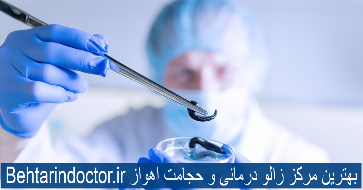 بهترین مرکز زالو درمانی و حجامت اهواز