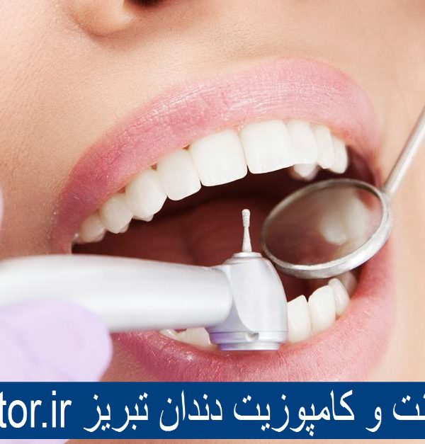 بهترین دکتر لمینت و کامپوزیت دندان تبریز