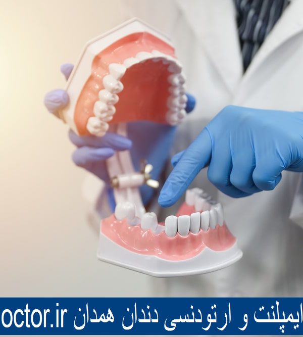 بهترین دکتر ایمپلنت و ارتودنسی دندان همدان