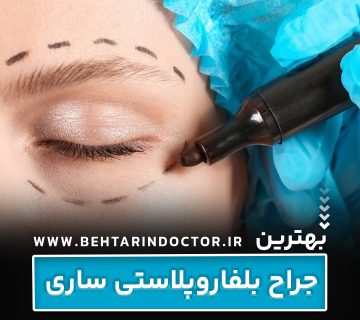 بهترین دکتر جراح بلفاروپلاستی ساری