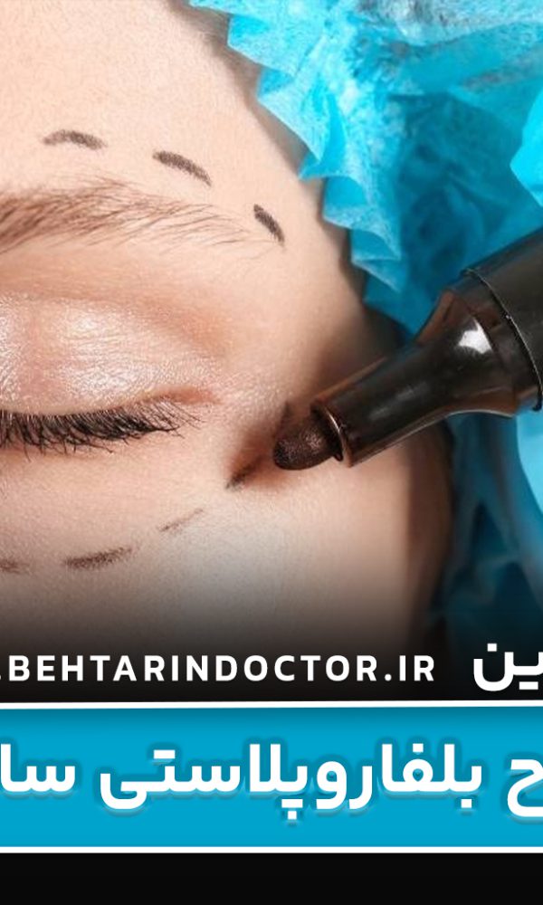 بهترین دکتر جراح بلفاروپلاستی ساری