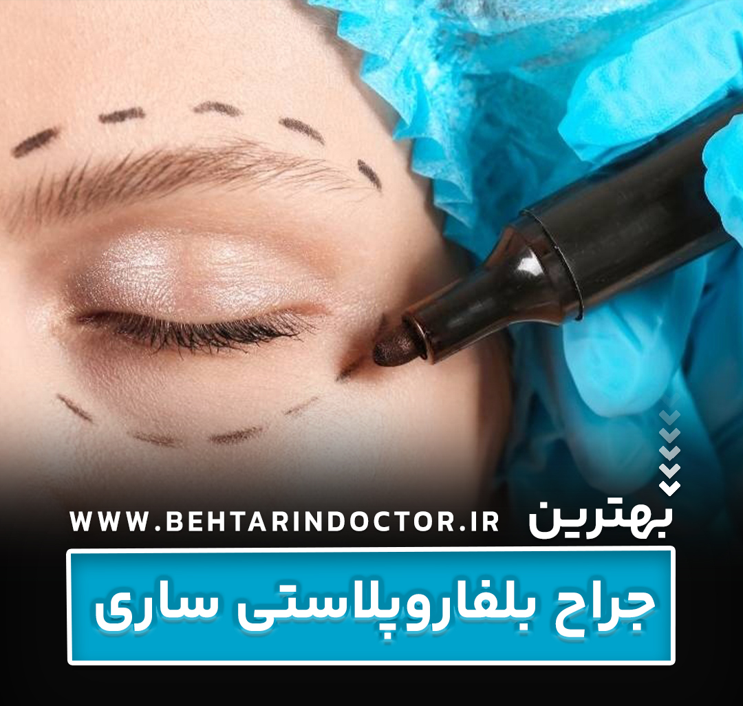 بهترین دکتر جراح بلفاروپلاستی ساری