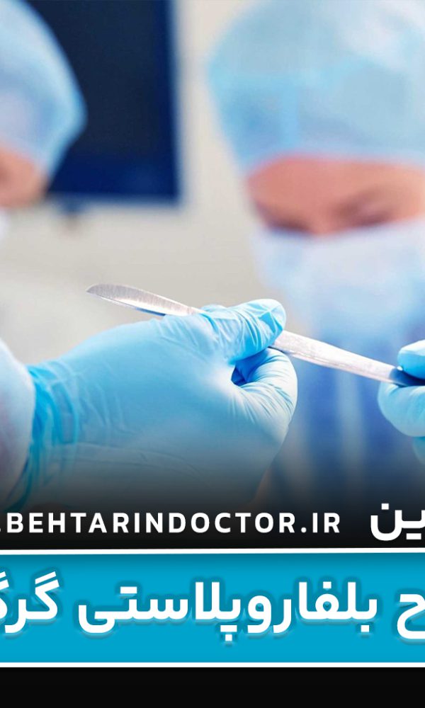 بهترین دکتر جراح بلفاروپلاستی گرگان