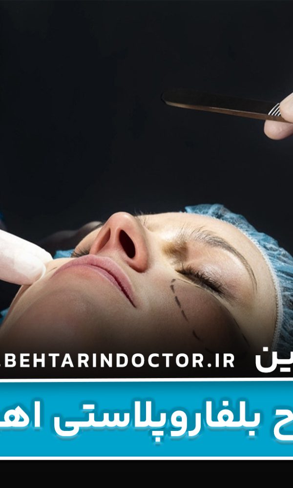 بهترین دکتر جراح بلفاروپلاستی اهواز
