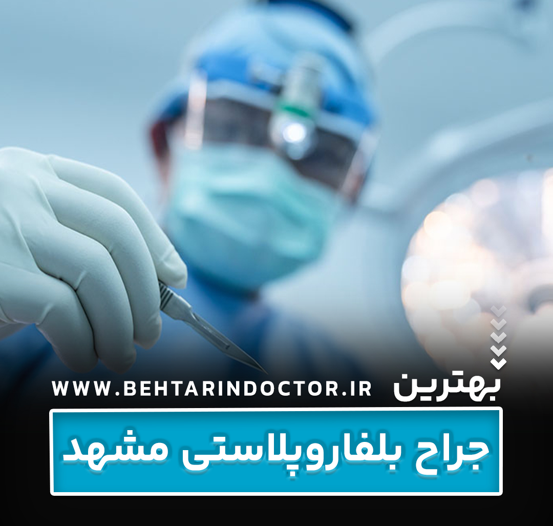 بهترین دکتر جراح بلفاروپلاستی مشهد