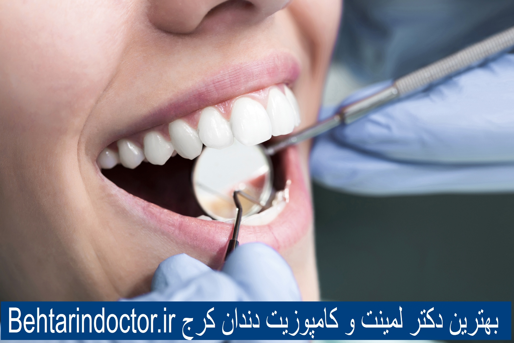 بهترین دکتر لمینت و کامپوزیت دندان کرج