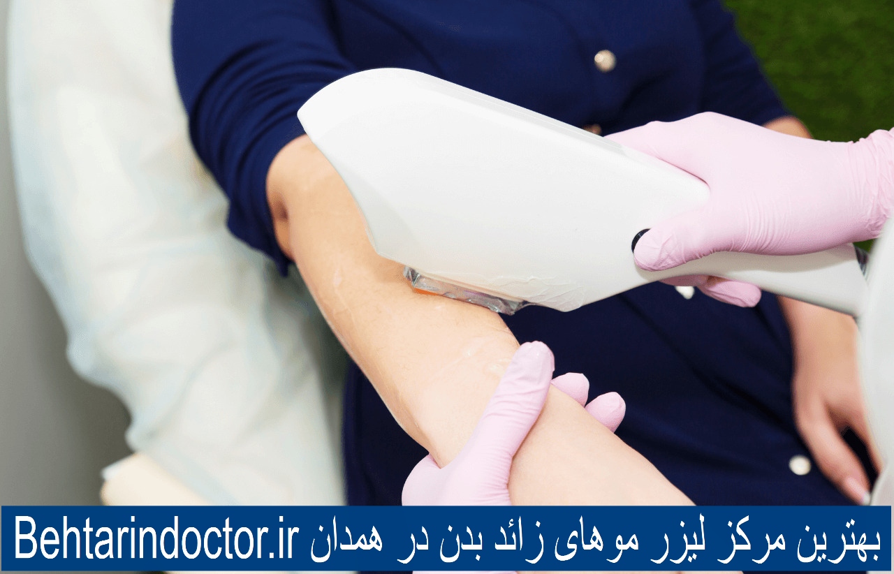 لیزر موهای زائد بدن - بهترین کلینیک زیبایی در همدان