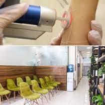 کلینیک پارسی مرکز لیزر موهای زائد بدن اصفهان