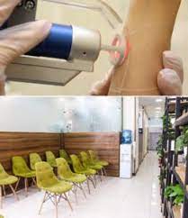 کلینیک پارسی مرکز لیزر موهای زائد بدن اصفهان