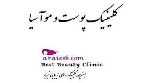 کلینیک آسیا مرکز لیزر موهای زائد بدن تبریز