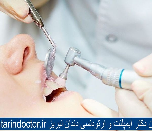 بهترین دکتر ایمپلنت و ارتودنسی دندان تبریز