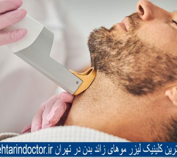 لیزر موهای زائد بدن