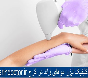 لیزر موهای زائد بدن - بهترین کلینیک زیبایی در کرج