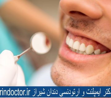 بهترین دکتر ایمپلنت و ارتودنسی دندان شیراز