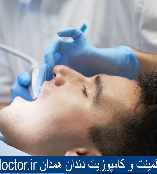 بهترین دکتر لمینت و کامپوزیت دندان همدان