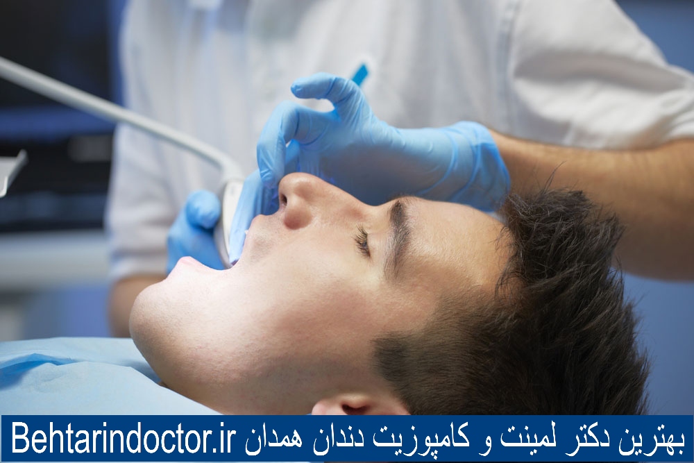 بهترین دکتر لمینت و کامپوزیت دندان همدان