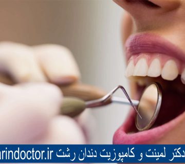 بهترین دکتر لمینت و کامپوزیت دندان رشت