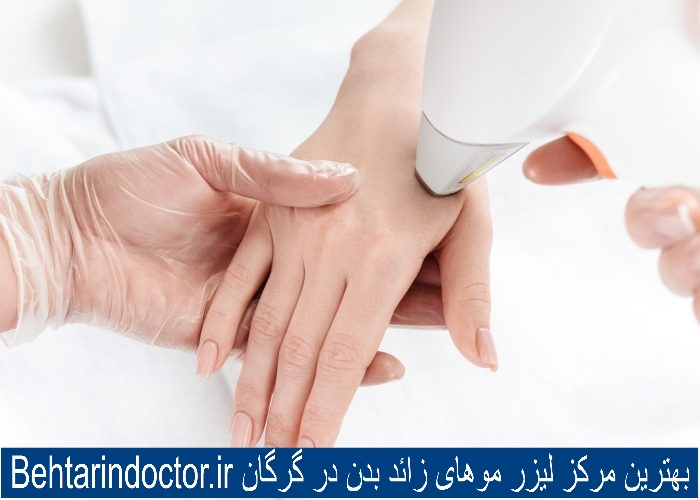 لیزر موهای زائد بدن - بهترین کلینیک زیبایی در گرگان
