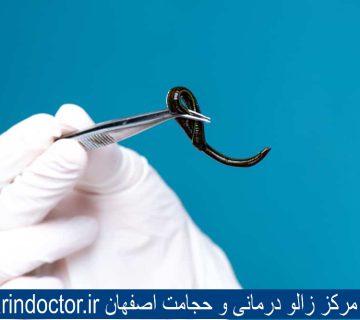 بهترین مرکز زالو درمانی و حجامت اصفهان