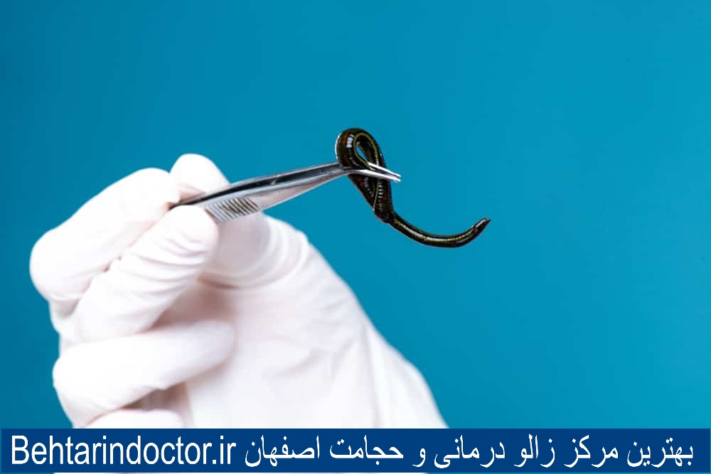 بهترین مرکز زالو درمانی و حجامت اصفهان