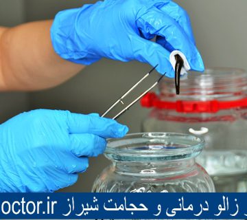 بهترین مرکز زالو درمانی و حجامت شیراز