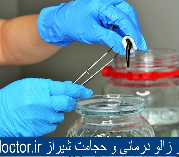 بهترین مرکز زالو درمانی و حجامت شیراز