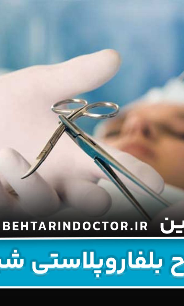 بهترین دکتر جراح بلفاروپلاستی شیراز