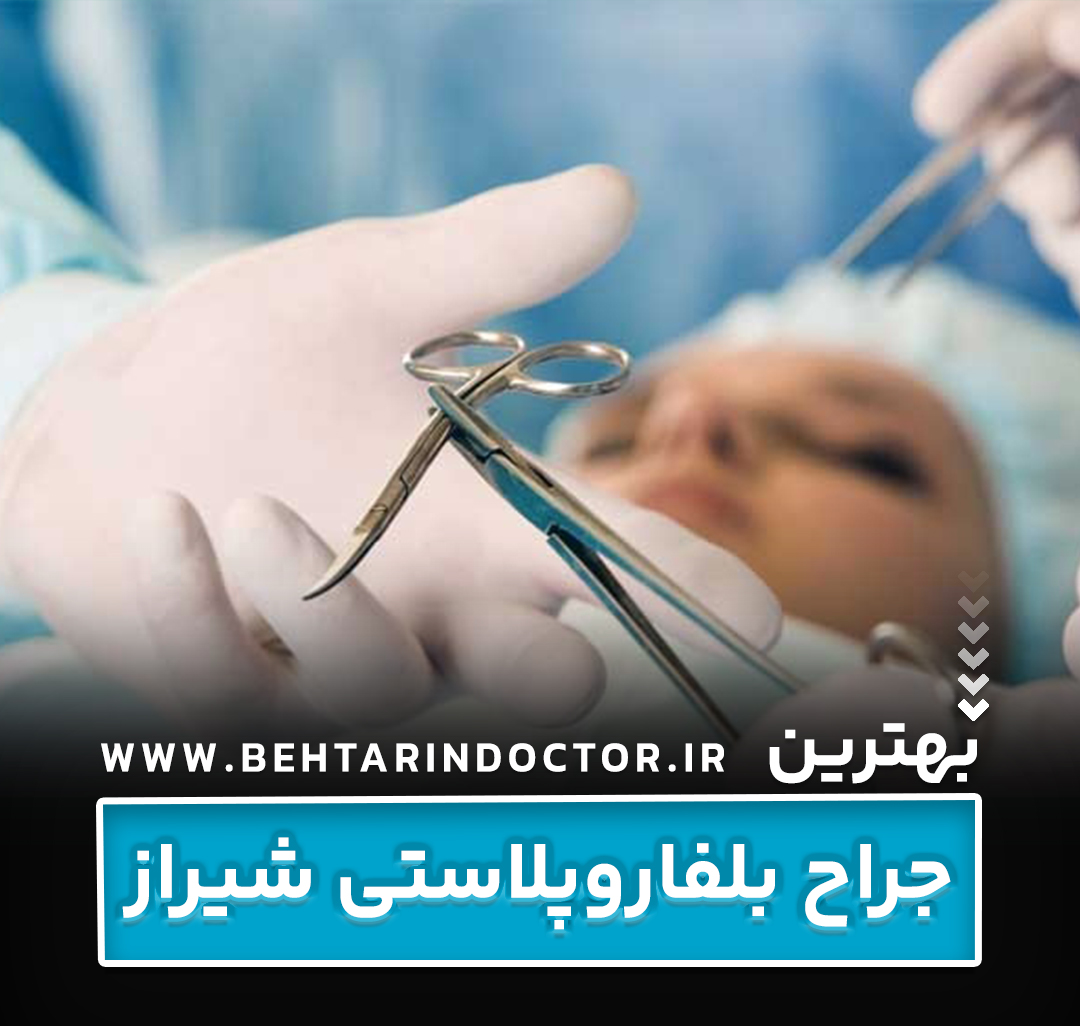 بهترین دکتر جراح بلفاروپلاستی شیراز