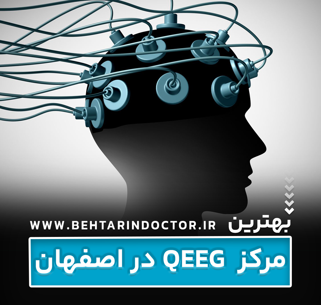 نقشه مغزی در اصفهان ، بهترین مرکز qeeg شهر اصفهان