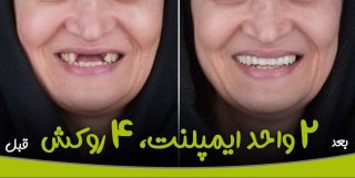 کلینیک دندانپزشکی نیکان ، بهترین دندانپزشکی اصفهان