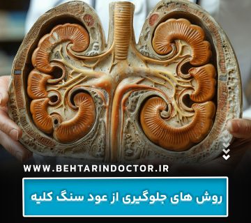 روش های جلوگیری از عود سنگ کلیه روش های جلوگیری از عود سنگ کلیه